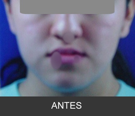 Caso clínico