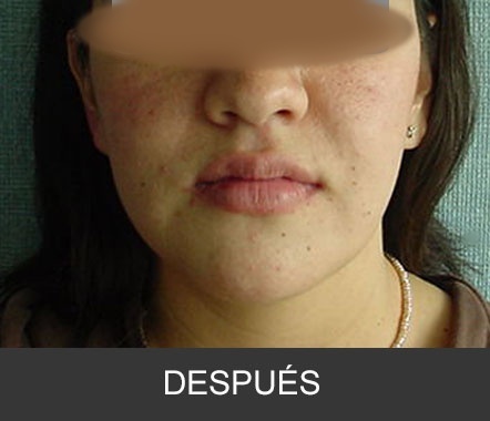 Caso clínico