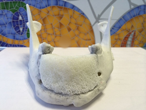 Injerto para reconstrucción mandibular