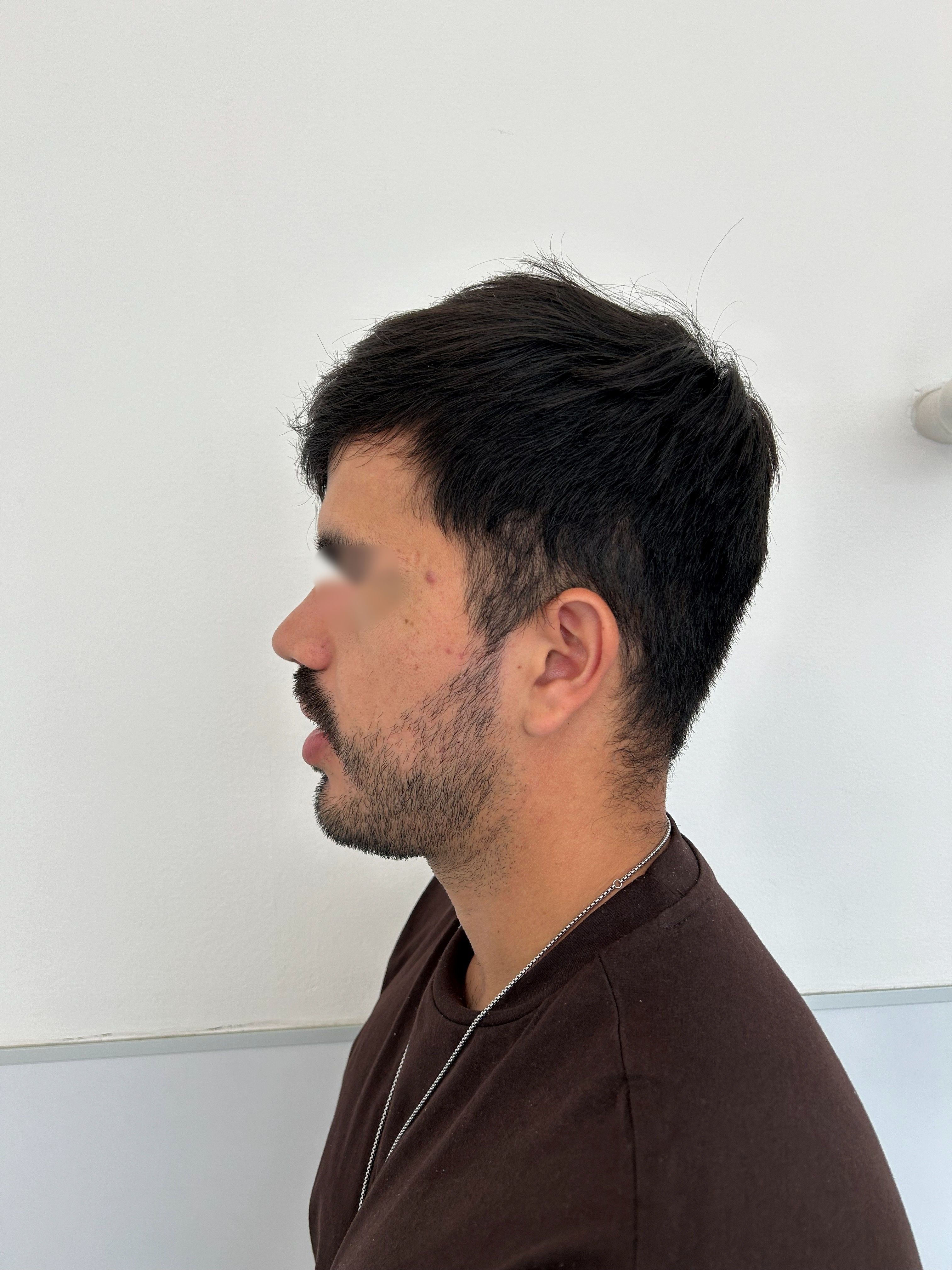 Antes