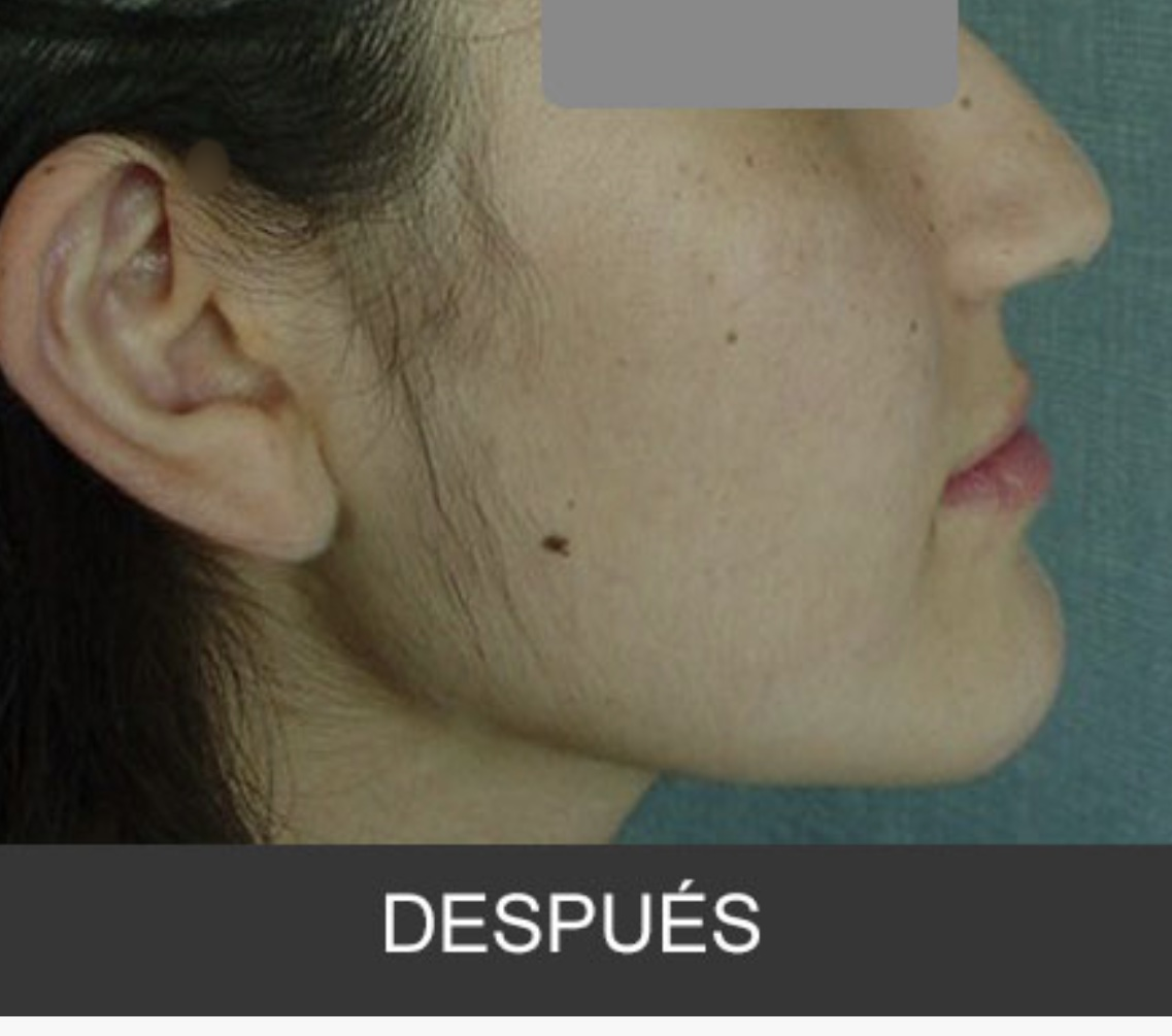 Después